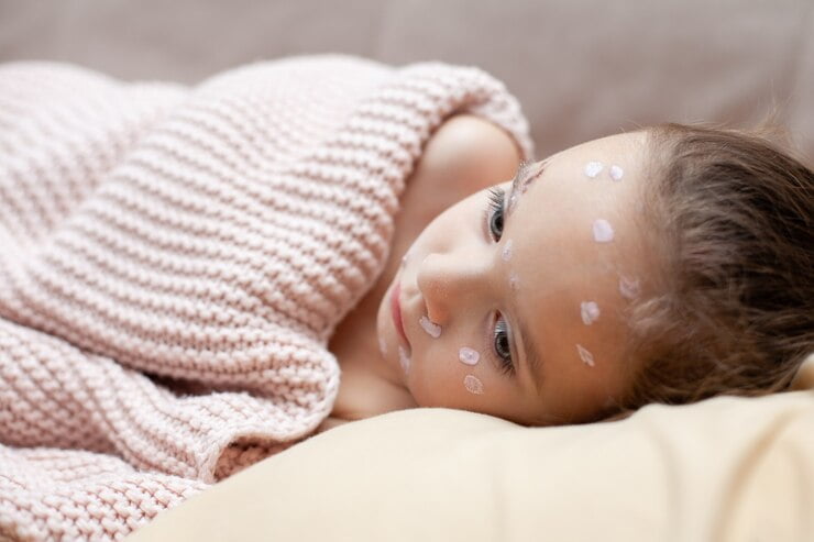 کرم پوست کودکانه نرم‌ کننده و آرام‌ بخش پوست